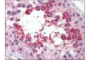Testis, Human: Formalin-Fixed, Paraffin-Embedded (FFPE) (Reticulon 4 anticorps)