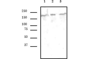 SMARCA4 antibody (mAb) (Clone 5B7) tested by Western blot. (SMARCA4 anticorps  (AA 213-295))