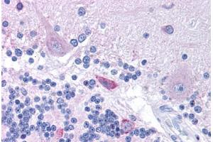 Human Brain, Cerebellum (formalin-fixed, paraffin-embedded) stained with HTR3B antibody ABIN214778 at 5 ug/ml followed by biotinylated goat anti-rabbit IgG secondary antibody ABIN481713, alkaline phosphatase-streptavidin and chromogen.