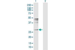 Western Blot analysis of FOSL1 expression in transfected 293T cell line by FOSL1 MaxPab polyclonal antibody. (FOSL1 anticorps  (AA 1-271))