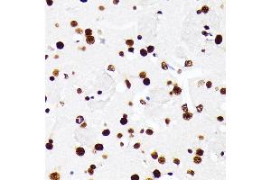 Immunohistochemistry of paraffin-embedded mouse brain using HNRNPD antibody (ABIN7267632) at dilution of 1:100 (40x lens).