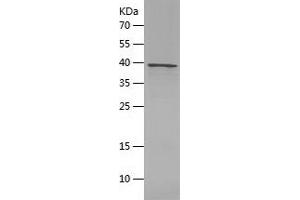Western Blotting (WB) image for Interleukin 7 (IL7) (AA 26-177) protein (His-IF2DI Tag) (ABIN7123614)