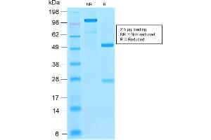 SDS-PAGE Analysis Purified Ferritin LC Rabbit Recombinant Monoclonal Antibody (FTL/2338R).