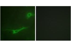 Immunofluorescence analysis of NIH-3T3 cells, using MUNC-18a (Ab-313) Antibody. (STXBP1 anticorps  (AA 279-328))