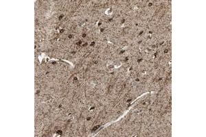 Immunohistochemical staining of human cerebral cortex with SHROOM4 polyclonal antibody  shows strong cytoplasmic positivity in neuronal cells at 1:50-1:200 dilution. (Shroom Family Member 4 (SHROOM4) anticorps)