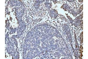 IHC analysis of ARL6IP6 using anti-ARL6IP6 antibody (ABIN7603020).