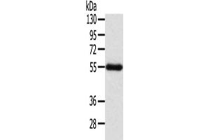 Gel: 8 % SDS-PAGE, Lysate: 60 μg, Lane: Human placenta tissue, Primary antibody: ABIN7192312(SEPN1 Antibody) at dilution 1/200, Secondary antibody: Goat anti rabbit IgG at 1/8000 dilution, Exposure time: 2 minutes (SEPN1 anticorps)