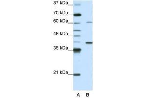 MGC46336 antibody used at 0. (ZNF843 anticorps  (N-Term))