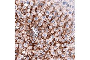 Immunohistochemical staining (Formalin-fixed paraffin-embedded sections) of human liver shows strong membranous immunoreactivity in hepatocytes.