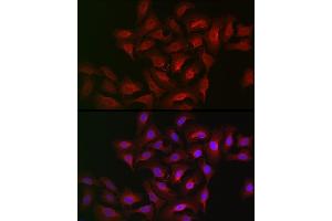 Immunofluorescence analysis of U2OS cells using B Rabbit pAb (ABIN6129899, ABIN6136816, ABIN6136817 and ABIN6222589) at dilution of 1:100 (40x lens). (ALOX15B anticorps  (AA 1-200))