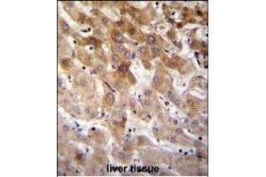MBTD1 Antibody (C-term) (ABIN655319 and ABIN2844896) immunohistochemistry analysis in formalin fixed and paraffin embedded human liver tissue followed by peroxidase conjugation of the secondary antibody and DAB staining. (MBTD1 anticorps  (C-Term))