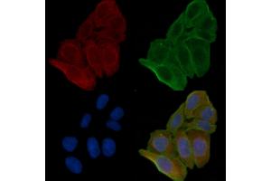ABIN6262776 and ABIN6266570 staining Hela cells(24h of starvation treatment) by IF/ICC. (KRT17 anticorps  (C-Term))