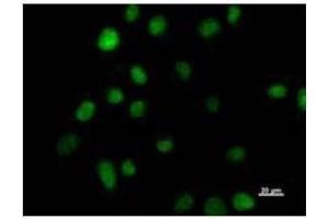 Immunostaining analysis in HeLa cells.