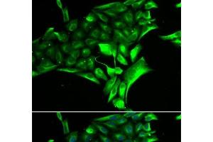Immunofluorescence analysis of MCF-7 cells using PYGB Polyclonal Antibody (PYGB anticorps)