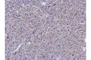 IHC-P Image Immunohistochemical analysis of paraffin-embedded RT2 xenograft, using PTPN12, antibody at 1:500 dilution.