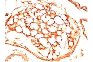 Mouse visceral fat tissue was stained by Rabbit Anti-sFRP-2 (25-50) (Human) Antiserum (SFRP2 anticorps  (AA 25-50))