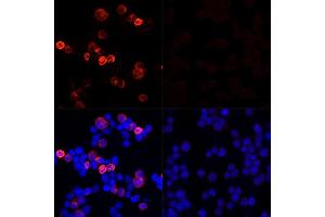Immunofluorescence analysis of 293T cells transfected with SARS-CoV-2 Spike protein and untreated 293T cells use SARS-CoV-2 Spike Rabbit pAb (ABIN7266506) at dilution of 1:100 (40x lens). (Coronavirus Spike Glycoprotein anticorps)