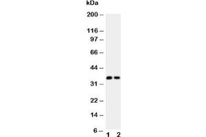Western blot testing of Calbindin antibody (0. (CALB1 anticorps  (AA 2-175))
