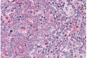 Human Spleen: Formalin-Fixed, Paraffin-Embedded (FFPE)