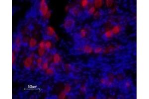Expression of TRPV1 in rat DRG - Immunohistochemical staining of rat dorsal root ganglion (DRG) frozen sections using Anti-Rat TRPV1 (VR1) (extracellular) Antibody (ABIN7043838, ABIN7043986 and ABIN7043987), (1:100) followed by goat anti-rabbit-ATTO Fluor-594 secondary antibody (red).