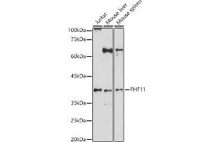 Western blot analysis of extracts of various cell lines, using PHF11 antibody (ABIN6128438, ABIN6145534, ABIN6145536 and ABIN6223765) at 1:1000 dilution. (PHF11 anticorps  (AA 1-292))