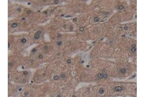 Detection of AATK in Human Liver Tissue using Polyclonal Antibody to Apoptosis Associated Tyrosine Kinase (AATK) (AATK anticorps  (AA 1216-1374))