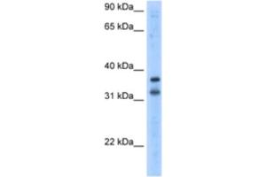 Western Blotting (WB) image for anti-Potassium Channel Regulator (KCNRG) antibody (ABIN2461173) (KCNRG anticorps)