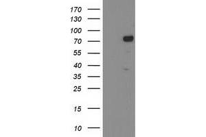 Western Blotting (WB) image for anti-Katanin P80 (WD Repeat Containing) Subunit B 1 (KATNB1) antibody (ABIN1498987) (KATNB1 anticorps)