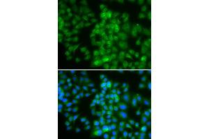 Immunofluorescence analysis of HeLa cell using LMO4 antibody. (LMO4 anticorps)