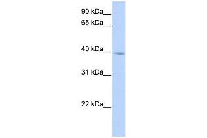 WB Suggested Anti-IQCD Antibody Titration: 0. (IQCD anticorps  (N-Term))