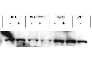 Western blot using  affinity purified anti-Smad3 antibody shows detection of endogenous Smad3 in both unstimulated and stimulated cell lysates. (SMAD3 anticorps  (C-Term))