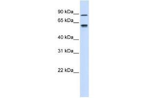 EFEMP1 antibody used at 1 ug/ml to detect target protein. (FBLN3 anticorps  (Middle Region))