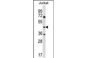 Western blot analysis in Jurkat cell line lysates (35ug/lane). (ASS1 anticorps  (C-Term))