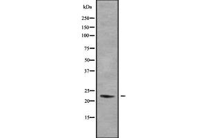 Western blot analysis of DUX5 using HeLa whole cell lysates (DUX5 anticorps  (N-Term))