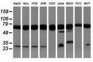 Image no. 3 for anti-Pseudouridylate Synthase 7 Homolog (PUS7) antibody (ABIN1500514) (PUS7 anticorps)