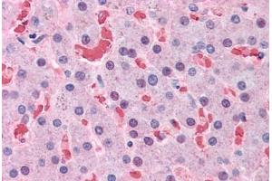 Human Liver: Formalin-Fixed, Paraffin-Embedded (FFPE)