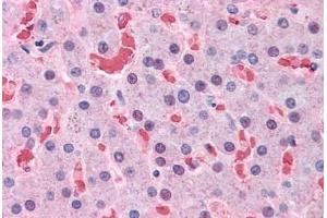 Human Liver: Formalin-Fixed, Paraffin-Embedded (FFPE) (Hemoglobin Subunit beta anticorps  (AA 38-148))