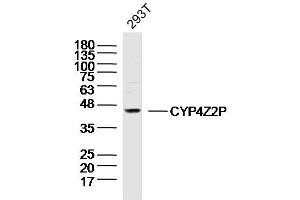 293T lysates probed with CYP4Z2P Polyclonal Antibody, Unconjugated  at 1:300 dilution and 4˚C overnight incubation. (CYP4Z2P anticorps  (AA 51-150))