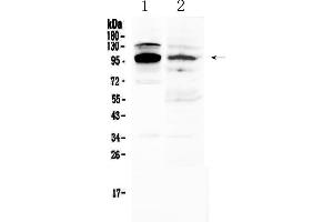 Western blot analysis of NFAT2 using anti-NFAT2 antibody . (NFATC1 anticorps  (AA 589-652))