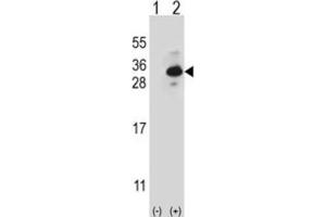 Western Blotting (WB) image for anti-Clathrin, Light Chain B (CLTB) antibody (ABIN2997028) (CLTB anticorps)