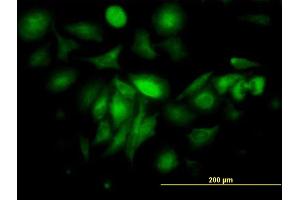 Immunofluorescence of monoclonal antibody to FTL on HeLa cell. (FTL anticorps  (AA 1-175))