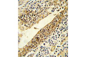 Immunohistochemistry (IHC) image for anti-Cytochrome P450, Family 51, Subfamily A, Polypeptide 1 (CYP51A1) antibody (ABIN3003944) (CYP51A1 anticorps)