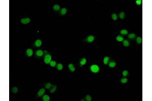 Immunofluorescence staining of Hela cells with ABIN7139605 at 1:7.