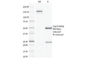 SDS-PAGE Analysis of Purified, BSA-Free Factor XIIIa Antibody (clone F13A1/1683). (F13A1 anticorps  (AA 46-181))