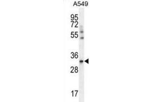 Western Blotting (WB) image for anti-Solute Carrier Family 25 (Mitochondrial Carrier, Adenine Nucleotide Translocator), Member 6 (SLC25A6) antibody (ABIN2996577)