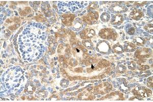 Human kidney (SPTLC1 anticorps  (Middle Region))