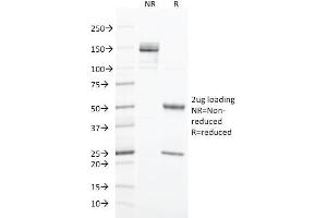 SDS-PAGE Analysis Purified Cytokeratin 20 Mouse Monoclonal Antibody (SPM191).