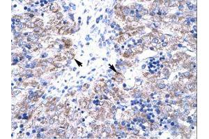 Image no. 1 for anti-HIV-1 Tat Interactive Protein 2, 30kDa (HTATIP2) (AA 30-79) antibody (ABIN202114)