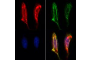 ABIN6260239 and ABIN6273094 staining Hela by IF/ICC. (BCO2 anticorps  (Internal Region))