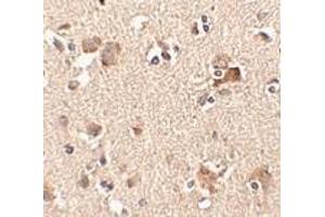 Immunohistochemistry of Aipl1 in human brain tissue with Aipl1 antibody at 2. (AIPL1 anticorps  (Center))